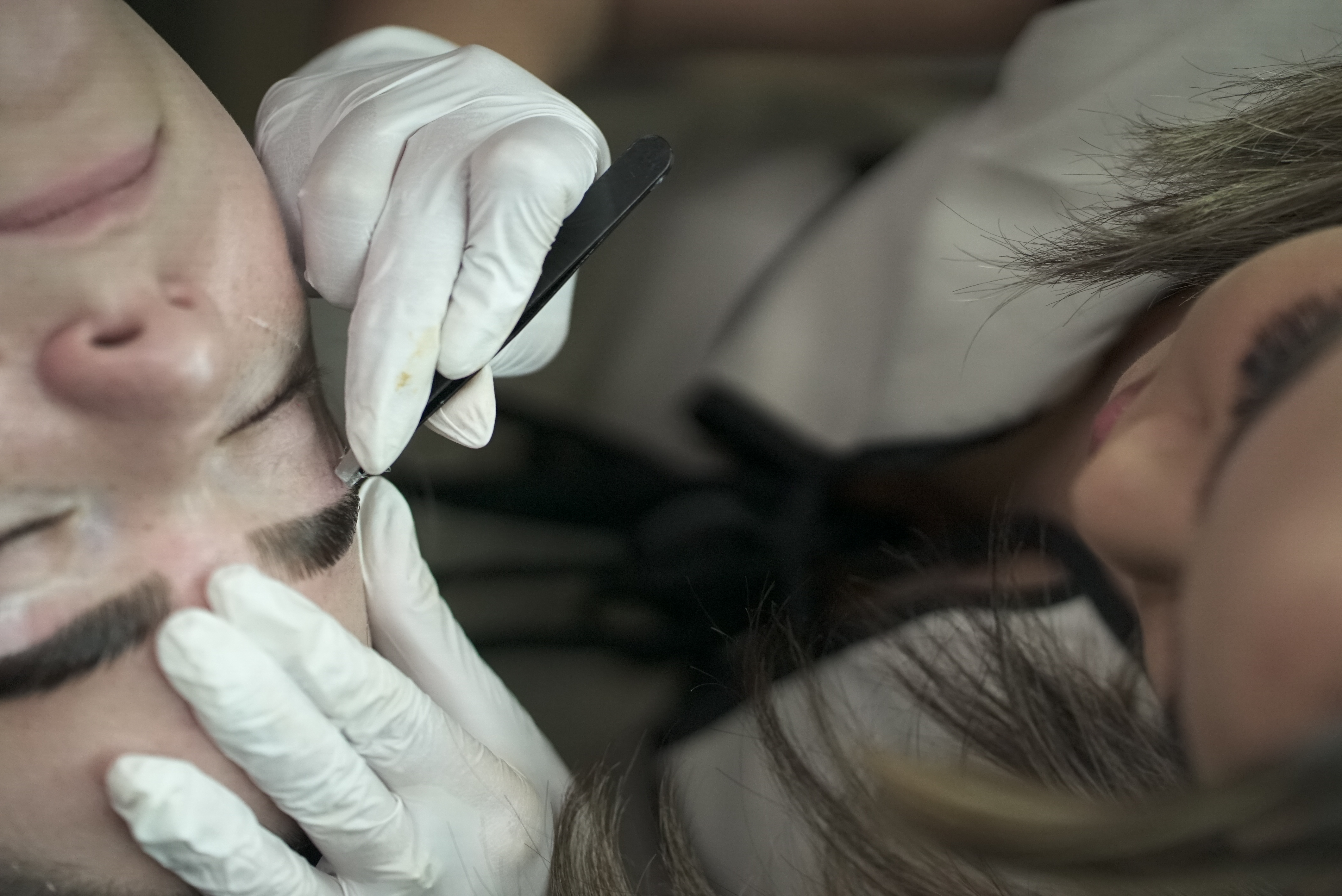 Depilación Facial por Zonas